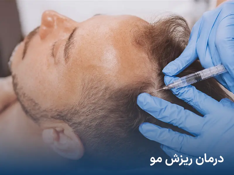 درمان ریزش مو در کلینیک آرت اسکین