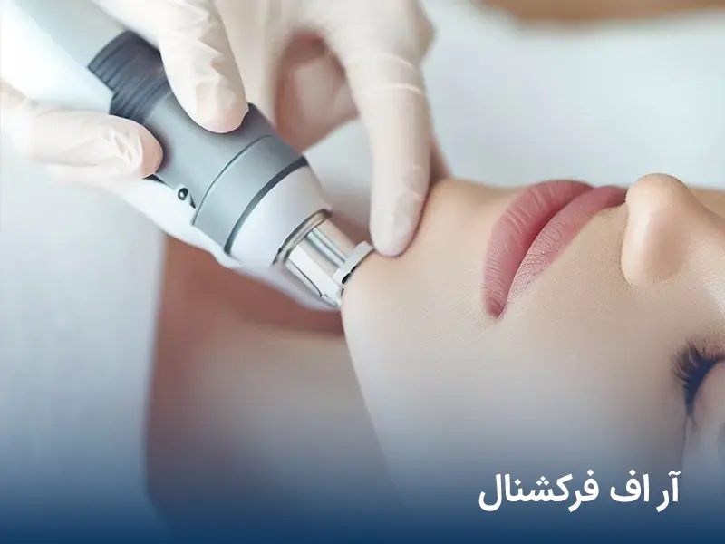لیزر آر اف فرکشنال در آرت اسکین